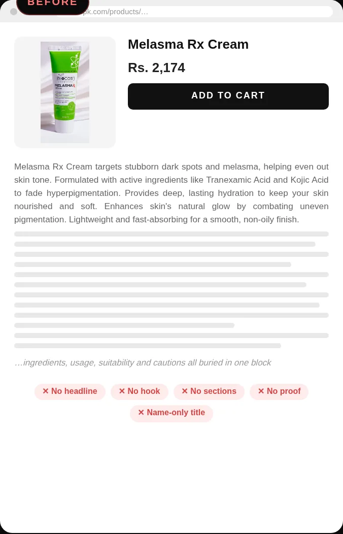 Before: Biocos Melasma Rx Cream product page with a name-only title and a single paragraph