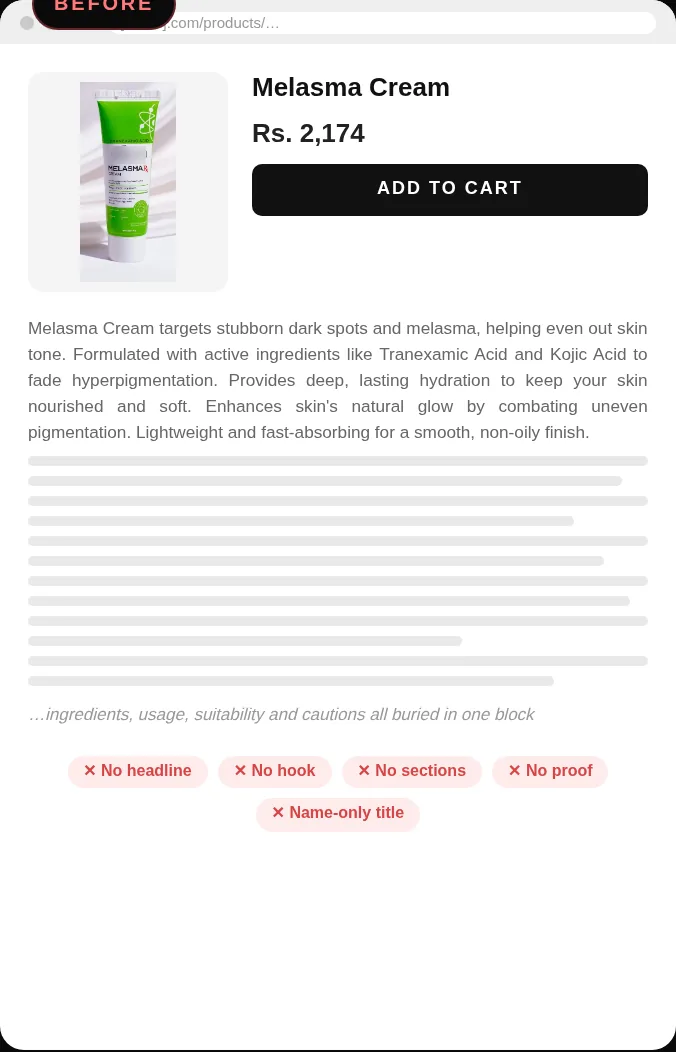 Before: Skincare Brand in Pakistan Melasma Cream product page with a name-only title and a single paragraph